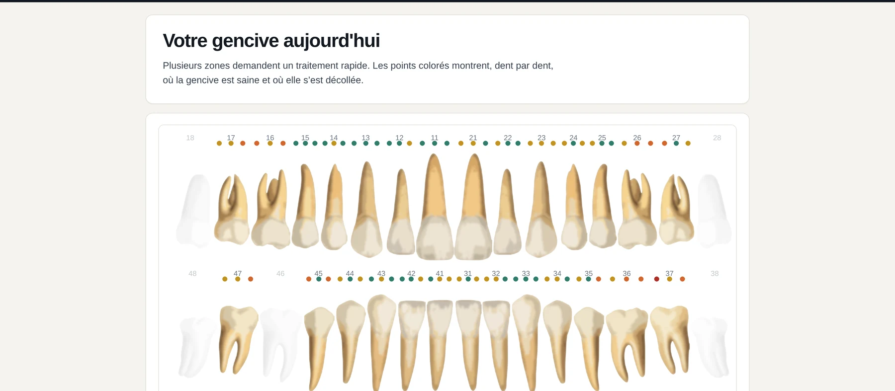 La vue destinée au patient